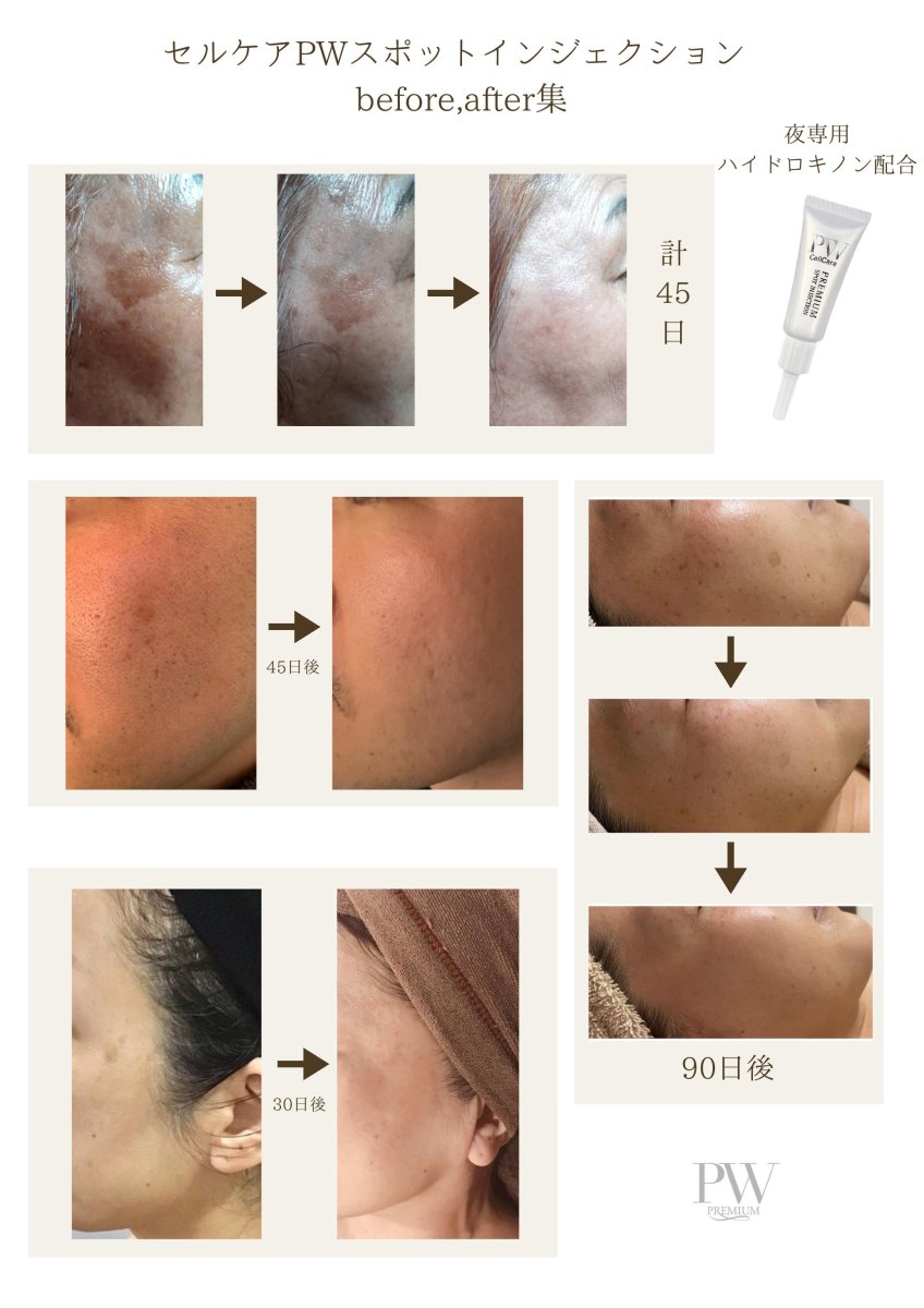 画像2: シミケア・美白商材・メニュー説明会 (2)